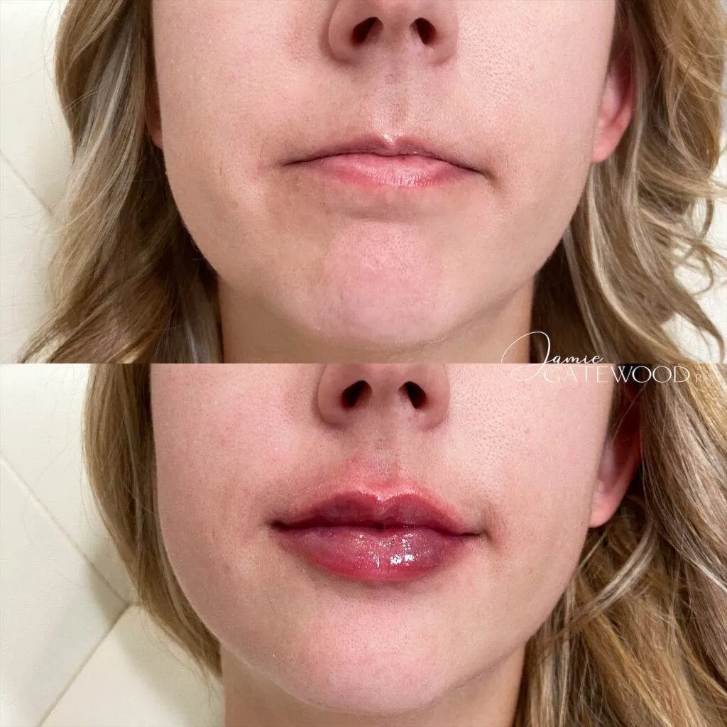 Botox clinic near me, Dermal filler clinic near me in Phoenix