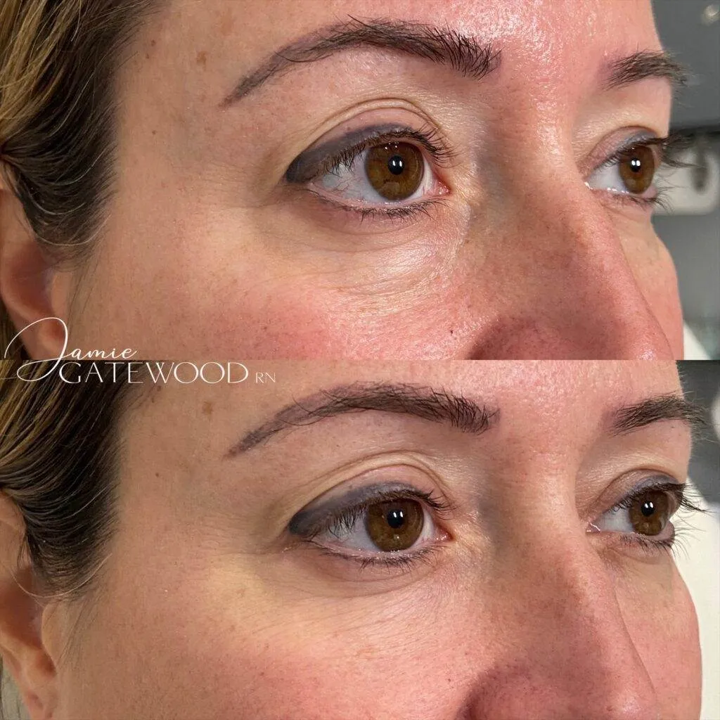 Best Botox clinic near me, Best Dermal filler clinic near me in Phoenix