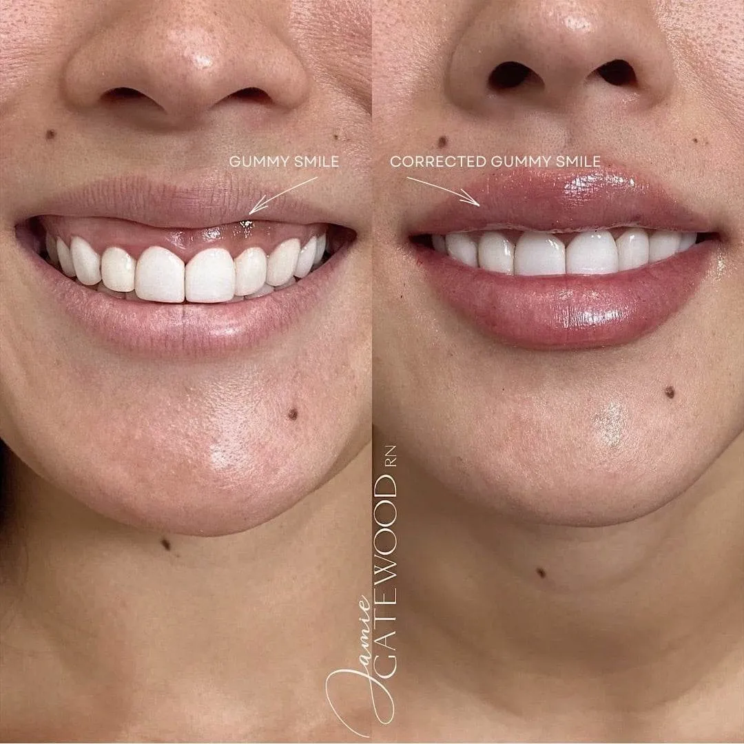 Processed with VSCO with ss2 preset