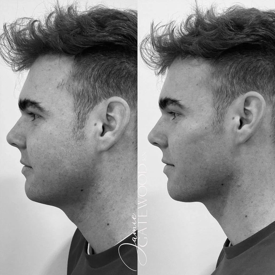 Male Jawline and Cheeks