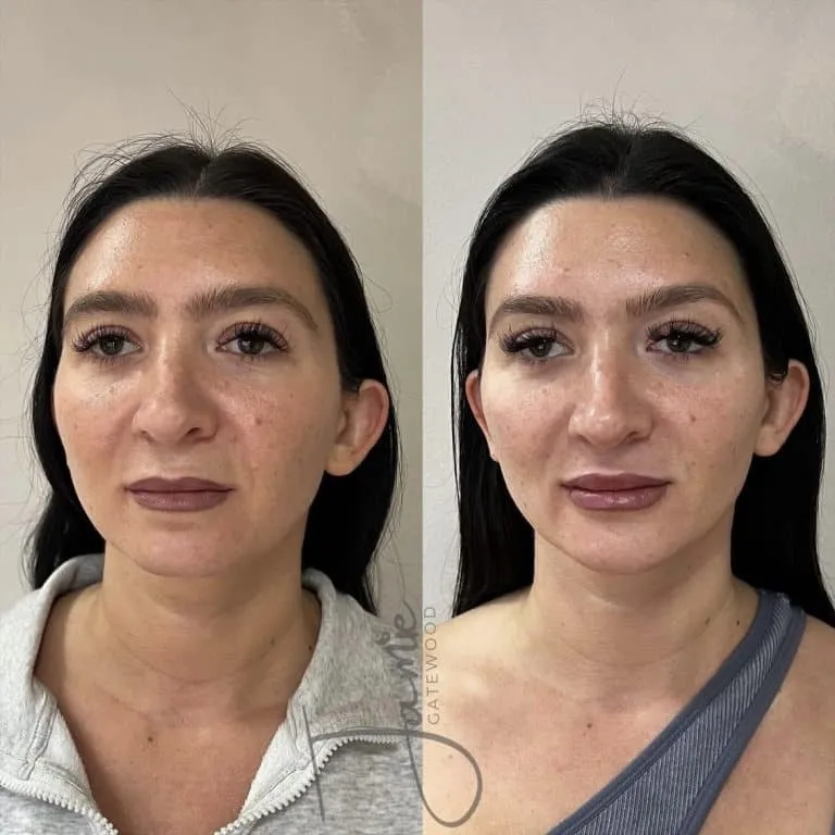 Phoenix Arizona Facial Balancing
