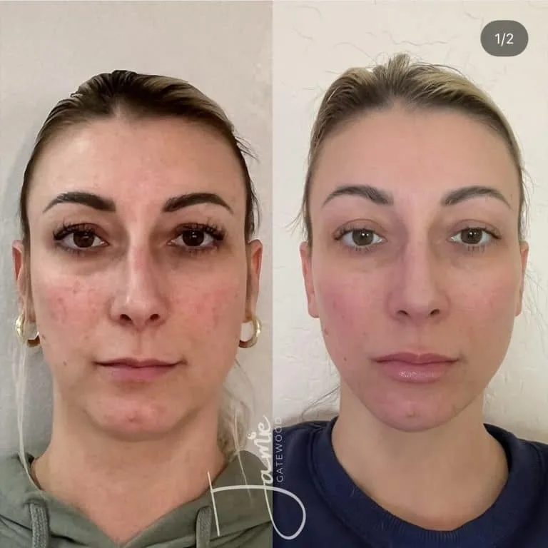 Phoenix AZ Facial Balancing AluminEye Eye Cream