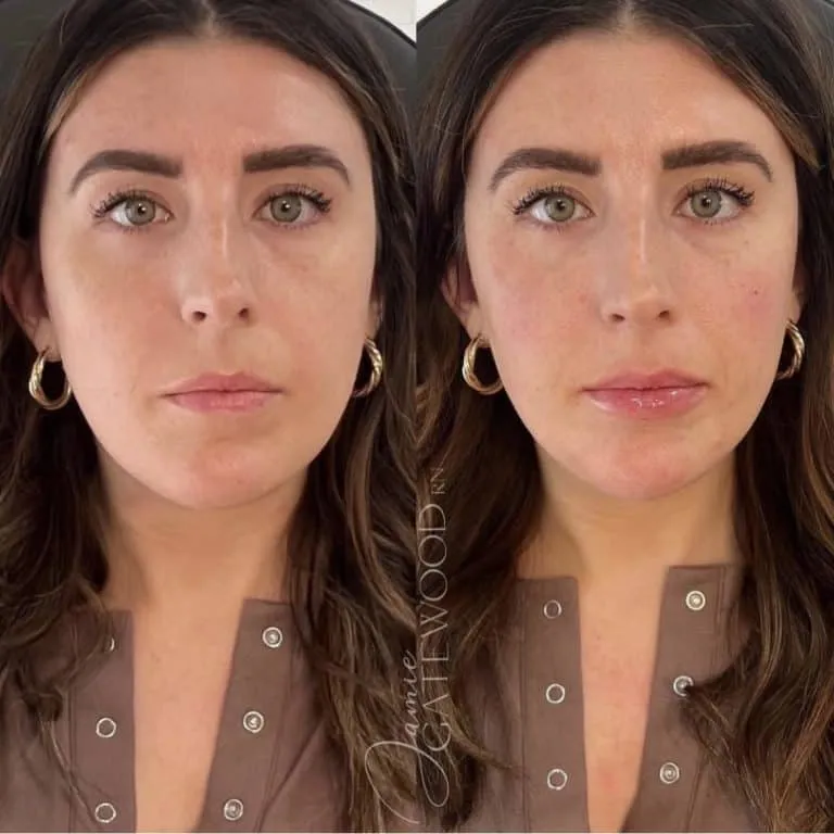 Temple AZ Facial Balancing