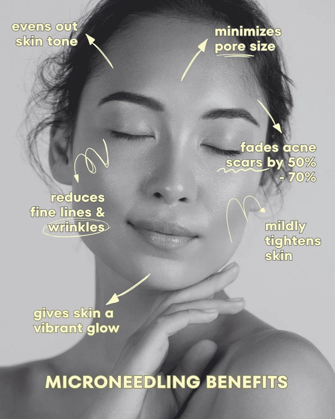 Phoenix Arizona Microneedling Benefits
