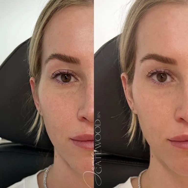 Scottsdale Arizona Temple Filler