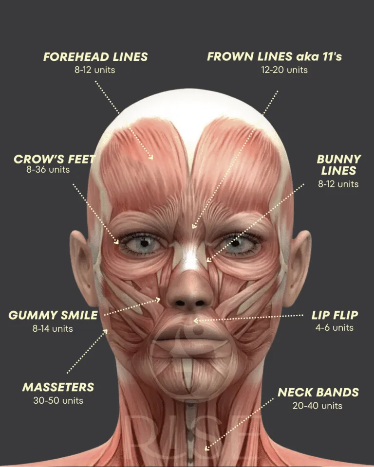phoenix arizona neuromodulator neurotoxin typical dosages units